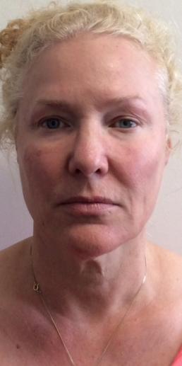 vollure-