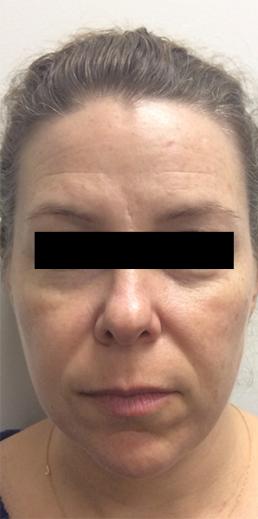 cosmetic-dermatology-