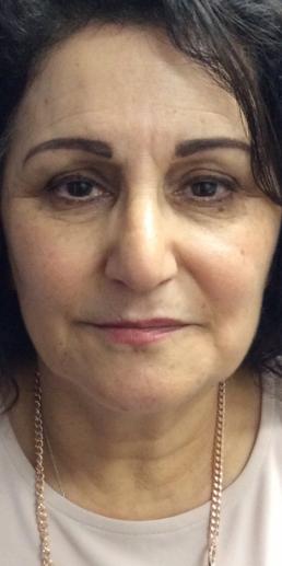 vollure-
