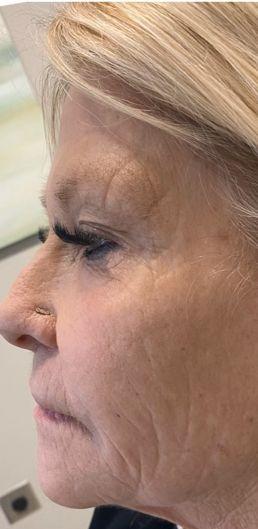 voluma-