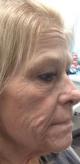 voluma-