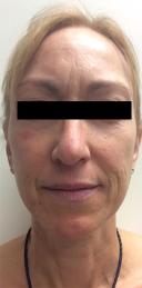 cosmetic-dermatology-