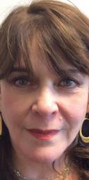 juvederm-