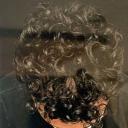 prp-hair-restoration-